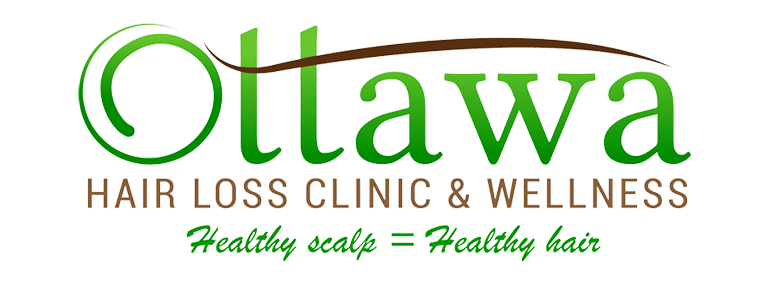 Ottawa Hair Loss Clinic